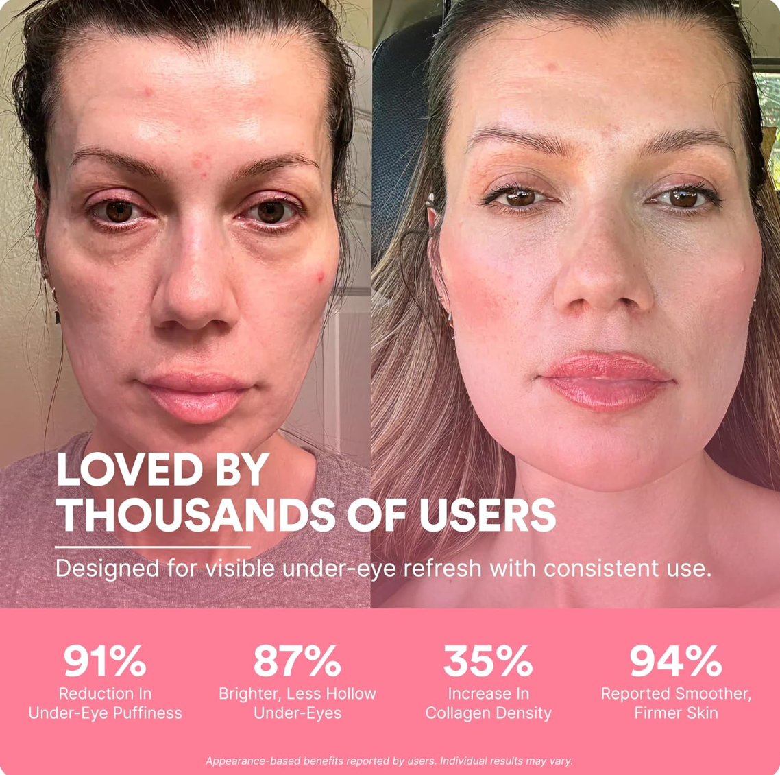 Orvae® 2-in-1 Red Light Therapy + EMS To Erase Eye Bags