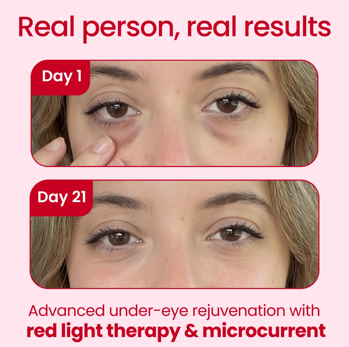 Orvae® 2-in-1 Red Light Therapy + EMS To Erase Eye Bags
