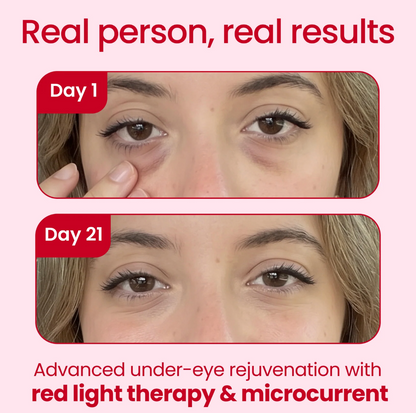 Orvae® 2-in-1 Red Light Therapy + EMS To Erase Eye Bags